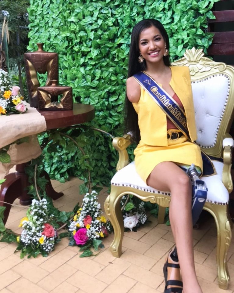 สวยและสู้! Vicco Salcedo สาวไร้แขนและขาซ้าย ร่วมชิงมง Miss Ecuador 2021