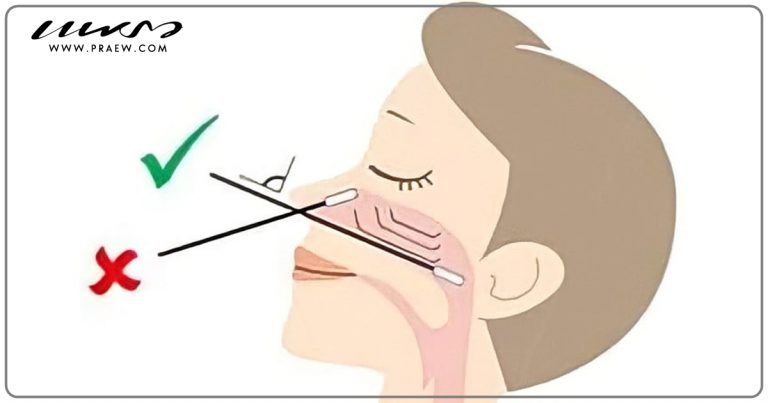 ตรวจโควิด-19 ด้วยตัวเองผิดวิธี เสี่ยงจมูกอักเสบ และอาจได้ผลไม่ตรง