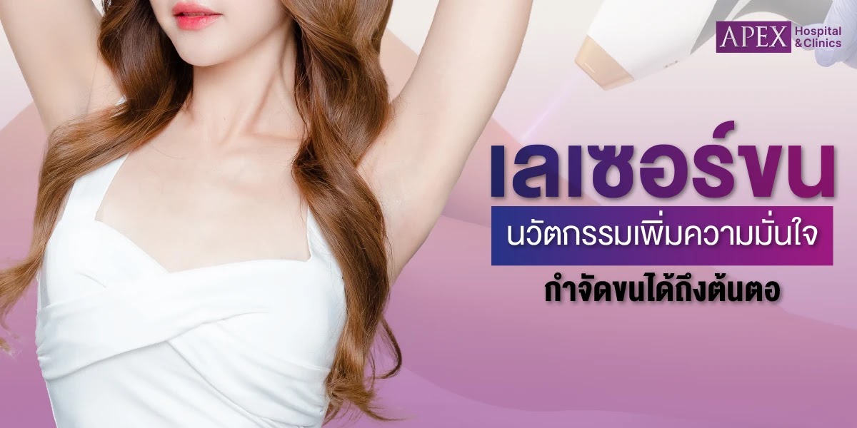 เลเซอร์ขน