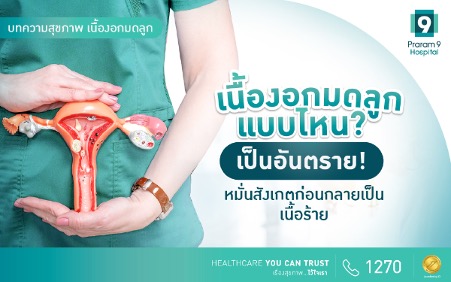 เนื้องอกมดลูก