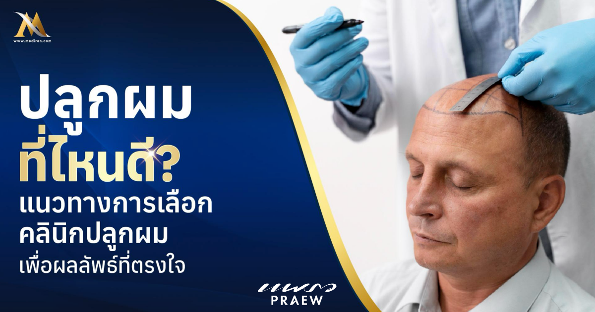 ปลูกผมที่ไหนดี
