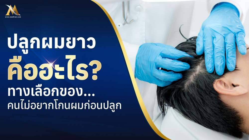 ปลูกผมยาว