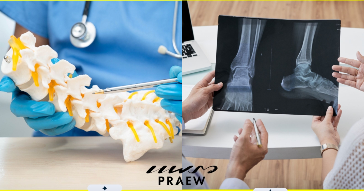Orthopedic